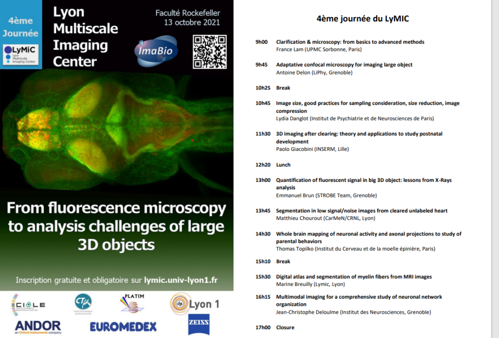 Image 4ème Journée LyMIC - « De la microscopie à fluorescence aux défis d'analyse des grands objets 3D » 